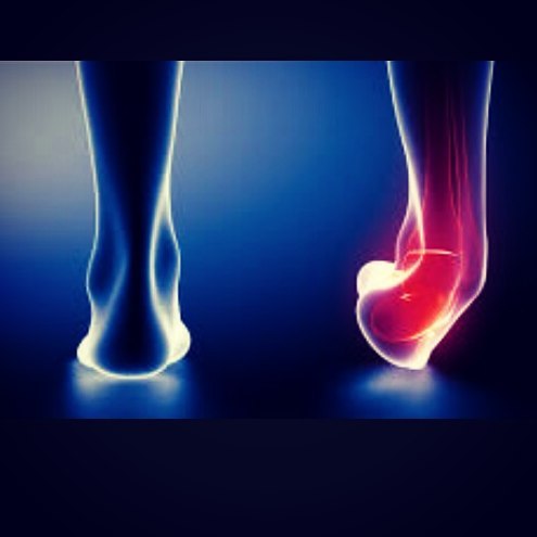 ترجمه مهندسی پزشکی - بررسی شبیه سازهای وارونگی و پیچ خوردگی مچ پا در آزمایشگاه بیومکانیک