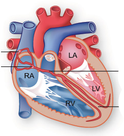 ترجمه آناتومی مهندسی پزشکی - سیستم دهلیزی