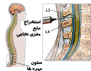 ترجمه پزشکی بیوشیمی بالینی کاربردی-آنالیز مایع نخاعی